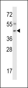 NIM1K / NIM1 Antibody - Mouse Nim1 Antibody western blot of mouse liver tissue lysates (35 ug/lane). The Nim1 antibody detected the Nim1 protein (arrow).