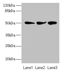 NIM1K / NIM1 Antibody - Western blot All lanes: Serine/threonine-protein kinase NIM1 antibody at 2µg/ml Lane 1: Jurkat whole cell lysate Lane 2: HepG2 whole cell lysate Lane 3: COLO205 whole cell lysate Secondary Goat polyclonal to rabbit IgG at 1/10000 dilution Predicted band size: 50 kDa Observed band size: 50 kDa