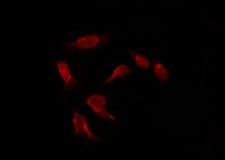 NIM1K / NIM1 Antibody - Staining HepG2 cells by IF/ICC. The samples were fixed with PFA and permeabilized in 0.1% Triton X-100, then blocked in 10% serum for 45 min at 25°C. The primary antibody was diluted at 1:200 and incubated with the sample for 1 hour at 37°C. An Alexa Fluor 594 conjugated goat anti-rabbit IgG (H+L) Ab, diluted at 1/600, was used as the secondary antibody.