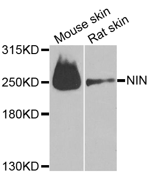 NIN / Ninein Antibody - Western blot blot of extracts of various cell lines, using NIN antibody.