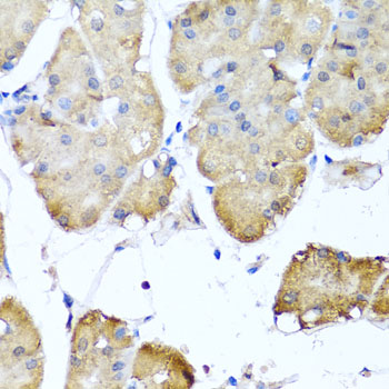 NIN / Ninein Antibody - Immunohistochemistry of paraffin-embedded human gastric using NIN antibody at dilution of 1:100 (x40 lens).