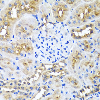NIN / Ninein Antibody - Immunohistochemistry of paraffin-embedded rat kidney using NIN antibody at dilution of 1:100 (x40 lens).
