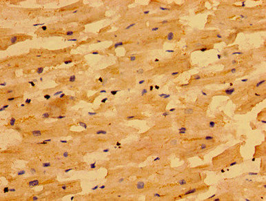 NIN / Ninein Antibody - Immunohistochemistry image of paraffin-embedded human heart tissue at a dilution of 1:100