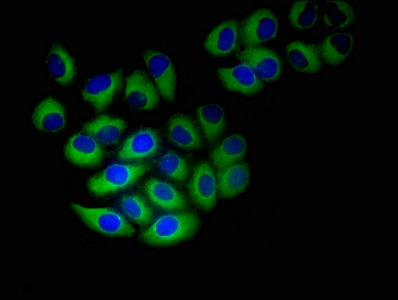 NINJ1 / Ninjurin Antibody - Immunofluorescent analysis of A549 cells using NINJ1 Antibody at dilution of 1:100 and Alexa Fluor 488-congugated AffiniPure Goat Anti-Rabbit IgG(H+L)