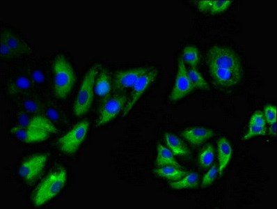 NINJ1 / Ninjurin Antibody - Immunofluorescent analysis of HepG2 cells using NINJ1 Antibody at dilution of 1:100 and Alexa Fluor 488-congugated AffiniPure Goat Anti-Rabbit IgG(H+L)