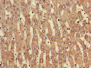 NINJ1 / Ninjurin Antibody - Immunohistochemistry of paraffin-embedded human liver tissue using NINJ1 Antibody at dilution of 1:100