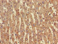 NINJ1 / Ninjurin Antibody - Immunohistochemistry of paraffin-embedded human liver tissue using NINJ1 Antibody at dilution of 1:100