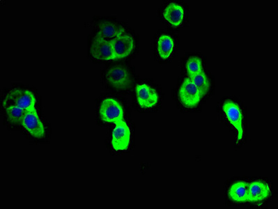 NINJ2 / Ninjurin 2 Antibody - Immunofluorescent analysis of A431 cells using NINJ2 Antibody at dilution of 1:100 and Alexa Fluor 488-congugated AffiniPure Goat Anti-Rabbit IgG(H+L)