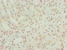 NINL Antibody - Immunohistochemistry of paraffin-embedded human adrenal gland tissue at dilution 1:100