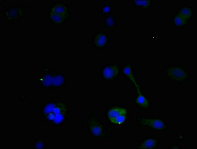 NIP3 / BNIP3 Antibody - Immunofluorescent analysis of MCF-7 cells using BNIP3 Antibody at dilution of 1:100 and Alexa Fluor 488-congugated AffiniPure Goat Anti-Rabbit IgG(H+L)