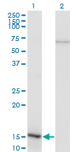 NIP45 / NFATC2IP Antibody - Western blot of NFATC2IP expression in transfected 293T cell line by NFATC2IP monoclonal antibody (M02), clone 3E9-B7.