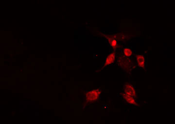 NIP45 / NFATC2IP Antibody - Staining HeLa cells by IF/ICC. The samples were fixed with PFA and permeabilized in 0.1% Triton X-100, then blocked in 10% serum for 45 min at 25°C. The primary antibody was diluted at 1:200 and incubated with the sample for 1 hour at 37°C. An Alexa Fluor 594 conjugated goat anti-rabbit IgG (H+L) Ab, diluted at 1/600, was used as the secondary antibody.