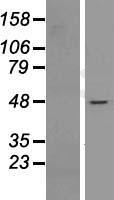 NIP45 / NFATC2IP Protein - Western validation with an anti-DDK antibody * L: Control HEK293 lysate R: Over-expression lysate