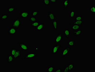 NIP7 Antibody - Immunofluorescent analysis of Hela cells using NIP7 Antibody at dilution of 1:100 and Alexa Fluor 488-congugated AffiniPure Goat Anti-Rabbit IgG(H+L)