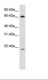 NIP7 Antibody - SVV620 Cell Lysate.  This image was taken for the unconjugated form of this product. Other forms have not been tested.