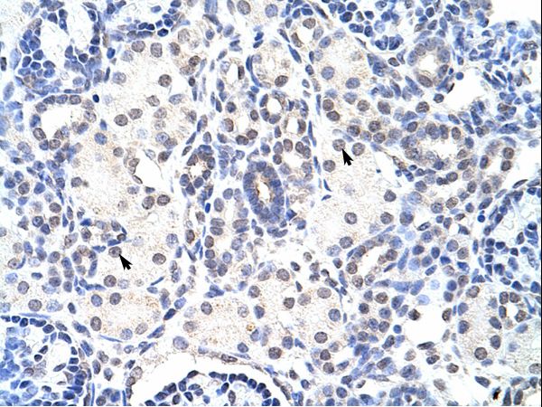 NIP7 Antibody - NIP7 antibody ARP40833_T100-NP_057185-NIP7 (nuclear import 7 homolog (S. cerevisiae)) Antibody was used in IHC to stain formalin-fixed, paraffin-embedded human kidney.  This image was taken for the unconjugated form of this product. Other forms have not been tested.