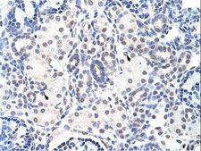 NIP7 Antibody - NIP7 antibody ARP40833_T100-NP_057185-NIP7 (nuclear import 7 homolog (S. cerevisiae)) Antibody was used in IHC to stain formalin-fixed, paraffin-embedded human kidney.  This image was taken for the unconjugated form of this product. Other forms have not been tested.