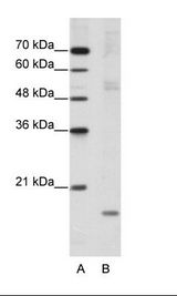 NIP7 Antibody - B: HepG2 Cell Lysate.  This image was taken for the unconjugated form of this product. Other forms have not been tested.