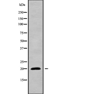 NIP7 Antibody - Western blot analysis NIP7 using LOVO cells whole cells lysates