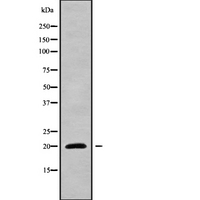 NIP7 Antibody - Western blot analysis NIP7 using LOVO cells whole cells lysates