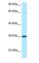 NIPA1 Antibody - NIPA1 antibody Western Blot of 721_B.  This image was taken for the unconjugated form of this product. Other forms have not been tested.