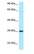 NIPA1 Antibody - NIPA1 antibody Western Blot of 721_B.  This image was taken for the unconjugated form of this product. Other forms have not been tested.