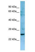 NIPAL3 / NPAL3 Antibody - NIPAL3 / NPAL3 antibody Western Blot of Fetal Thymus. Antibody dilution: 1 ug/ml.  This image was taken for the unconjugated form of this product. Other forms have not been tested.