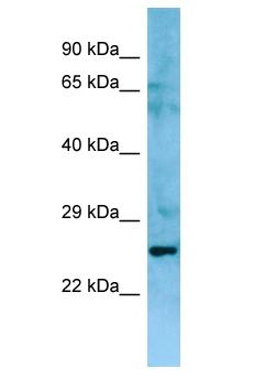 NIPAL3 / NPAL3 Antibody - NIPAL3 / NPAL3 antibody Western Blot of Fetal Thymus. Antibody dilution: 1 ug/ml.  This image was taken for the unconjugated form of this product. Other forms have not been tested.