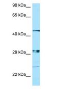 NIPAL3 / NPAL3 Antibody - NIPAL3 / NPAL3 antibody Western Blot of ACHN.  This image was taken for the unconjugated form of this product. Other forms have not been tested.