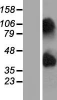 NIPAL4 Protein - Western validation with an anti-DDK antibody * L: Control HEK293 lysate R: Over-expression lysate
