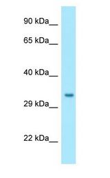 NIPSNAP1 Antibody - NIPSNAP1 antibody Western Blot of Fetal Liver.  This image was taken for the unconjugated form of this product. Other forms have not been tested.