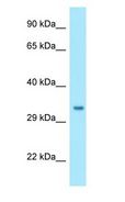 NIPSNAP1 Antibody - NIPSNAP1 antibody Western Blot of Fetal Liver.  This image was taken for the unconjugated form of this product. Other forms have not been tested.