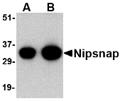 NIPSNAP1 Antibody - Western blot of NIPSNAP in human brain tissue lysate with NIPSNAP antibody at (A) 0.5 and (B) 1 ug/ml.