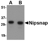NIPSNAP1 Antibody - Western blot of NIPSNAP in human brain tissue lysate with NIPSNAP antibody at (A) 0.5 and (B) 1 ug/ml.