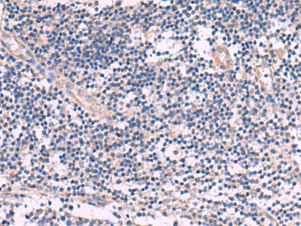 NIPSNAP1 Antibody - Immunohistochemistry of paraffin-embedded Human tonsil tissue  using NIPSNAP1 Polyclonal Antibody at dilution of 1:35(×200)