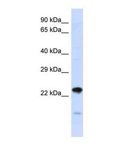 NIPSNAP3A Antibody - Western blot of Human HepG2. NIPSNAP3A antibody dilution 1.0 ug/ml.  This image was taken for the unconjugated form of this product. Other forms have not been tested.