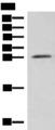 NIPSNAP3A Antibody - Western blot analysis of Mouse brain tissue lysate  using NIPSNAP3A Polyclonal Antibody at dilution of 1:550