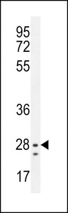 NIPSNAP3B Antibody - NIPSNAP3B Antibody western blot of mouse liver tissue lysates (35 ug/lane). The NIPSNAP3B antibody detected the NIPSNAP3B protein (arrow).