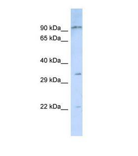 NIPSNAP3B Antibody - Western blot of Human Jurkat. NIPSNAP3B antibody dilution 1.0 ug/ml.  This image was taken for the unconjugated form of this product. Other forms have not been tested.