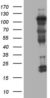 NIRF / UHRF2 Antibody - HEK293T cells were transfected with the pCMV6-ENTRY control. (Left lane) or pCMV6-ENTRY UHRF2. (Right lane) cDNA for 48 hrs and lysed. Equivalent amounts of cell lysates. (5 ug per lane) were separated by SDS-PAGE and immunoblotted with anti-UHRF2. (1:2000)