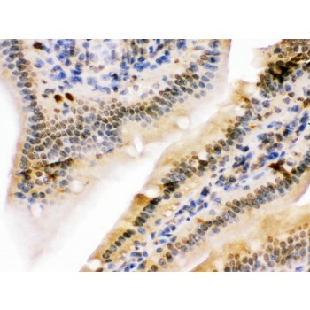 NIRF / UHRF2 Antibody - NIRF was detected in paraffin-embedded sections of rat intestine tissues using rabbit anti- NIRF Antigen Affinity purified polyclonal antibody at 1 ug/mL. The immunohistochemical section was developed using SABC method.