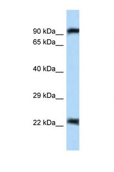 NIRF / UHRF2 Antibody - UHRF2 antibody Western blot of Mouse Pancreas lysate. Antibody concentration 1 ug/ml.  This image was taken for the unconjugated form of this product. Other forms have not been tested.