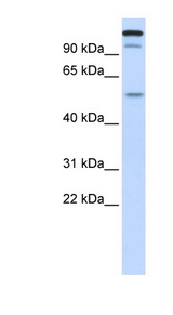 NIRF / UHRF2 Antibody - UHRF2 antibody Western blot of Fetal liver lysate. This image was taken for the unconjugated form of this product. Other forms have not been tested.