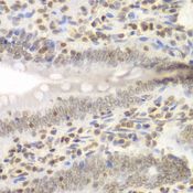 NIRF / UHRF2 Antibody - Immunohistochemistry of paraffin-embedded rat Intestine using UHRF2 antibody at dilution of 1:200 (40x lens).