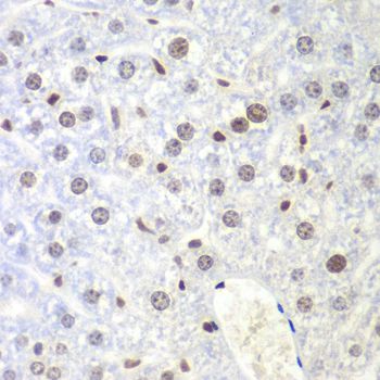 NIRF / UHRF2 Antibody - Immunohistochemistry of paraffin-embedded mouse liver using UHRF2 antibody at dilution of 1:200 (40x lens).