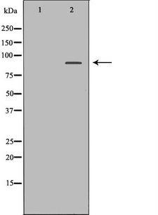 NIRF / UHRF2 Antibody - Western blot analysis of Jurkat whole cells lysates using UHRF2 antibody. The lane on the left is treated with the antigen-specific peptide.