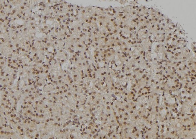 NIRF / UHRF2 Antibody - 1:100 staining rat kidney tissue by IHC-P. The sample was formaldehyde fixed and a heat mediated antigen retrieval step in citrate buffer was performed. The sample was then blocked and incubated with the antibody for 1.5 hours at 22°C. An HRP conjugated goat anti-rabbit antibody was used as the secondary.