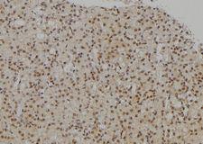 NIRF / UHRF2 Antibody - 1:100 staining rat kidney tissue by IHC-P. The sample was formaldehyde fixed and a heat mediated antigen retrieval step in citrate buffer was performed. The sample was then blocked and incubated with the antibody for 1.5 hours at 22°C. An HRP conjugated goat anti-rabbit antibody was used as the secondary.