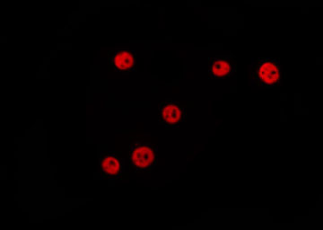NIRF / UHRF2 Antibody - Staining HepG2 cells by IF/ICC. The samples were fixed with PFA and permeabilized in 0.1% Triton X-100, then blocked in 10% serum for 45 min at 25°C. The primary antibody was diluted at 1:200 and incubated with the sample for 1 hour at 37°C. An Alexa Fluor 594 conjugated goat anti-rabbit IgG (H+L) Ab, diluted at 1/600, was used as the secondary antibody.