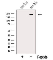 NISCH Antibody - Western blot analysis of extracts of mouse brain tissue using NISCH antibody. The lane on the left was treated with blocking peptide.